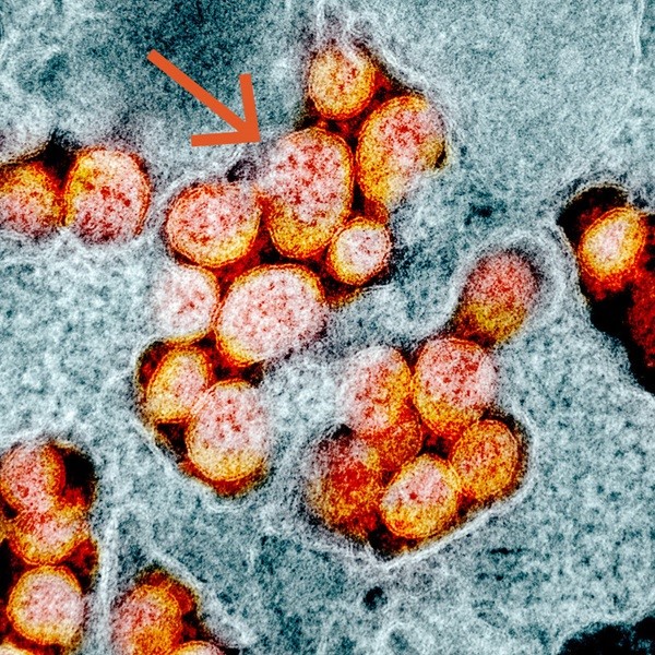 SARS-CoV-2-virus i et mikroskop